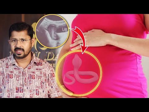महिला के पेट में सांप के बच्चे ने लिया जन्म जानिए सच्चाई | Bapi Da Snake Expert |
