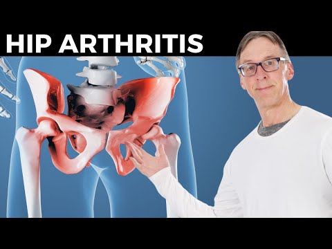 How Bob Relieves His Hip Arthritis In 10 Minutes