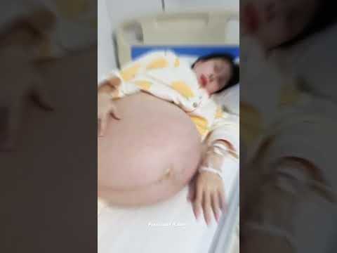 do you remember how painful it was on the day of childbirth