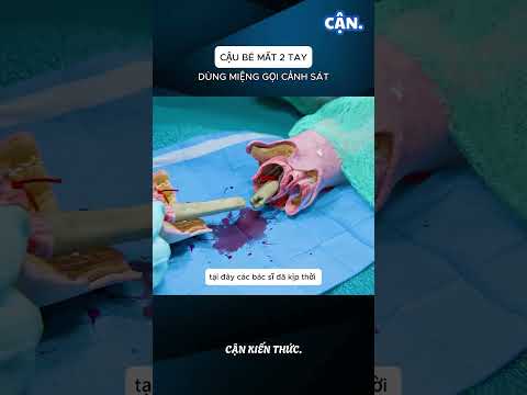 CẬU BÉ MẤT 2 TAY DÙNG MIỆNG GỌI CẢNH SÁT #xuhuong #shorts #viral #khampha #kienthuc