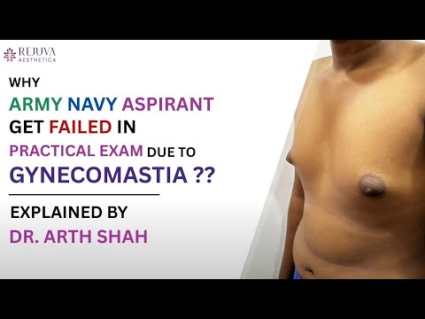 Why Gynecomastia leads to Army/Navy Rejection – Dr. Arth Shah explains!