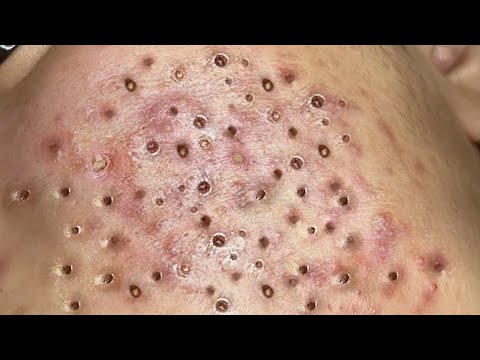 Most Relaxing and Satisfying with An Beauty TV Videos #2070
