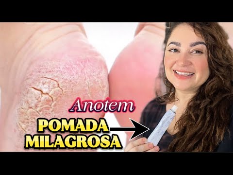 ESSA POMADA REMOVE RACHADURAS, CALOS E DEIXA O PÉ LISINHO!