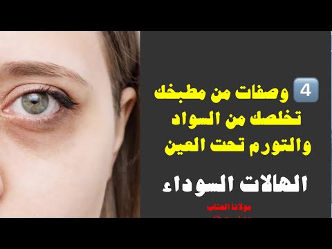 الهالات السوداء 4 وصفات من مطبخك تخلصك من السواد والتورم تحت العين