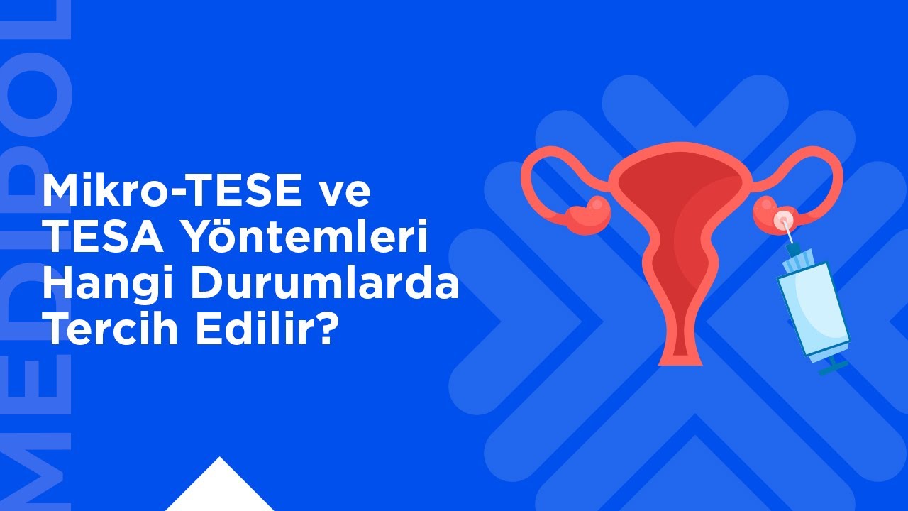 Tüp Bebek Tedavisinde Testisten Sperm Alma Yöntemleri: Mikro-TESE ve TESA