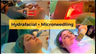 My Hydra Facial & Microneedling for Acne Prone Skin Experience with Dr Nada