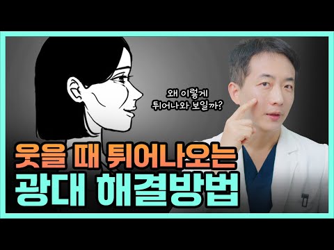 웃을 때 튀어나오는 광대, 이렇게 해결하세요!