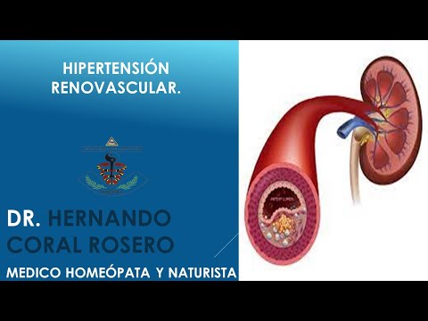 HIPERTENSION RENOVASCULAR