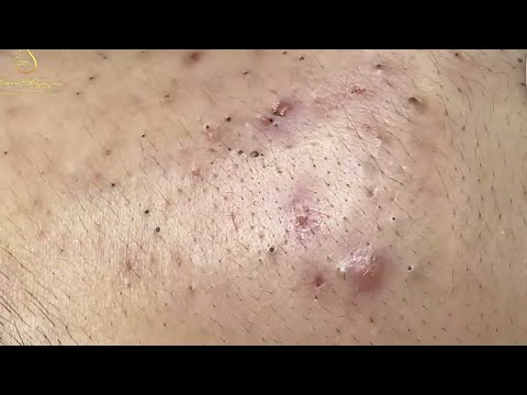 Most Relaxing and Satisfying with An Beauty TV Videos #2072