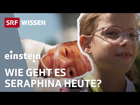 Ein Frühchen damals und heute – Vom Überlebenskampf zur Lebensfreude | Einstein | SRF Wissen