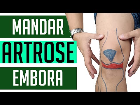 ARTROSE NO JOELHO - 4 EXERCÍCIOS PARA MELHORAR AGORA!