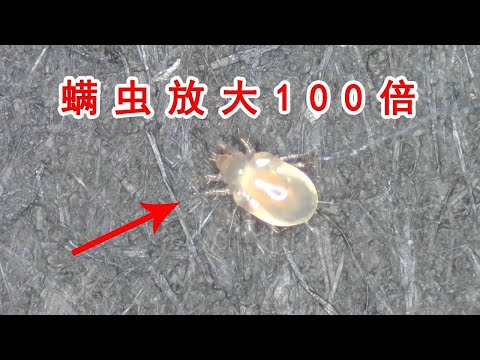 把蟎蟲放大100倍！顯微鏡下的蟎蟲長得這麼可愛！ 【歪點子實驗室】