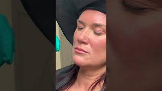 A Fuller Lip WITHOUT Filler? Try a LIP FLIP! #injection #beauty #shorts