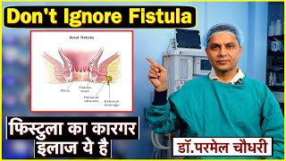 फिस्टुला का कारगर इलाज ये है don't ignore fistula || Technical Farming ||