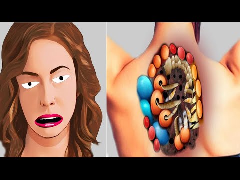 ASMR ANIMATION TREATMENT