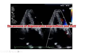 Intresting echo cases, Dr Hatim kheiralla, 6/7/2026
