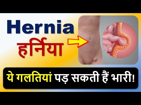 Hernia की ये गलतियां पड़ सकती हैं भारी!