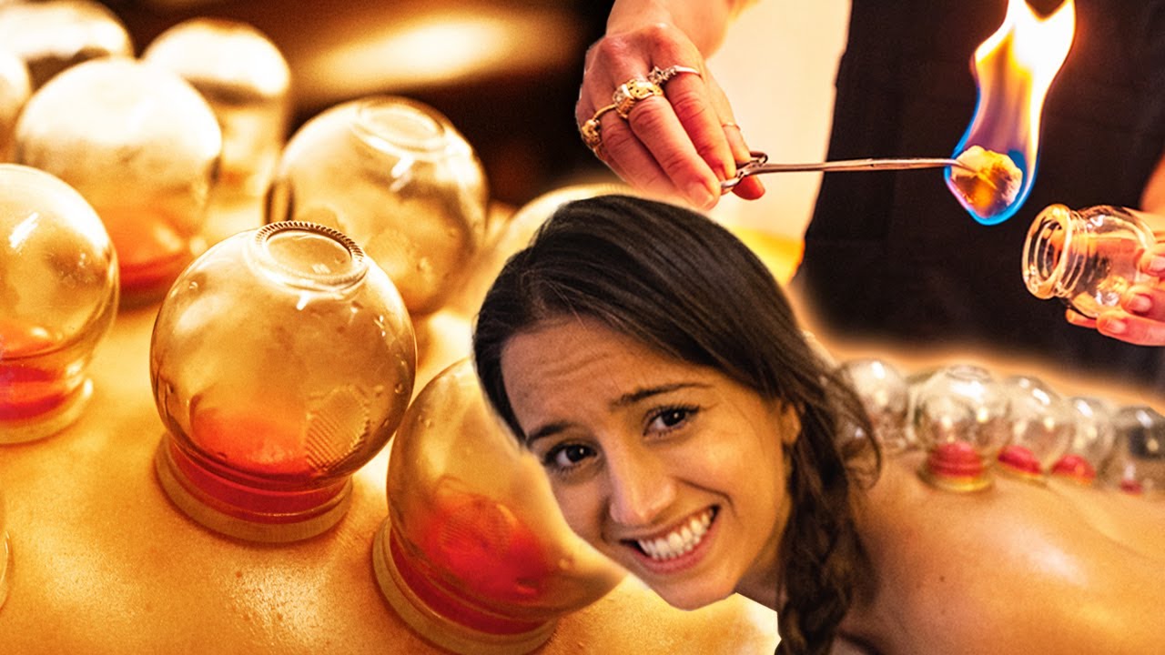 I Tried FIRE Cupping for the First Time (extreme massage) - Lexie Limitless