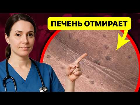 О чём молчит врач, но говорит ваша кожа? Признаки болезней на коже. Цвет, пятна и сухость кожи