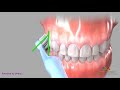 Dental Hygiene Techniques and Practices