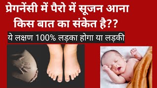 😱 प्रेगनेंसी में पैरों में सूजन आना किस बात का संकेत है⁉️ 7th month Pregnancy symptoms #pregnancy