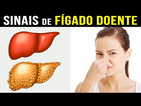 7 Sinais de PROBLEMA NO FÍGADO que a MAIORIA NÃO SABE!