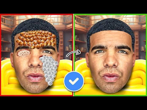 ASMR Remove Ticks And Maggot Infected From Drake | Severely Injured Treatment Animation