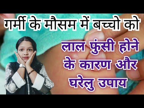 गर्मी के मौसम में बच्चो को लाल फुंसी होने के कारण और घरेलु उपाय - Bacche ko lal Dane Hona