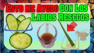 ¡Di Adiós a los Labios Secos con Estos Remedios Efectivos Caseros!✅✅🔴🔥