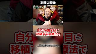 【実話】事故で両目を失明した男性→自分の歯で視力を取り戻す！？#shorts