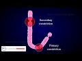 Chromosome Structure and Function