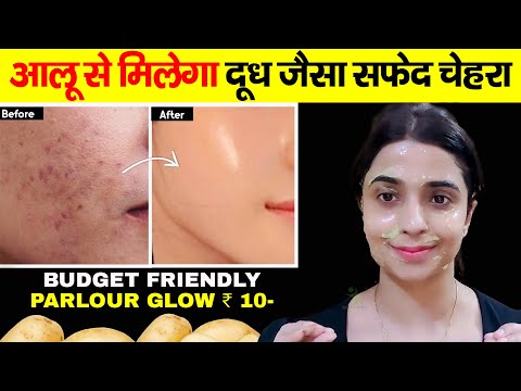 पार्टी में जाने से पहले बस एक बार लगालो चहरे की चमक देख सब चौक जयेंगे Instant Skin Whitening Remedy