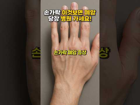 손가락 이것이 '폐암', 당장 병원 가세요! #건강 #건강정보