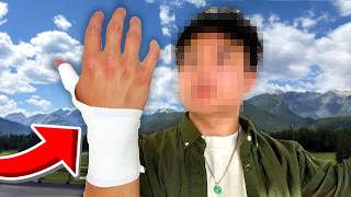 my hand is broken... again