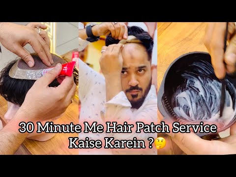 Khud Se Hair Patch Service Kaise Karein ? | Permanent Hair Patch Delhi | Hair Patch For Mens