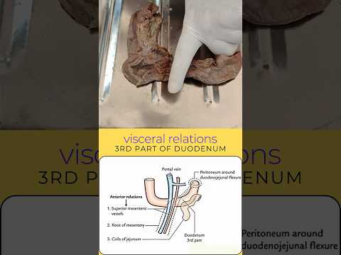 3rd part of duodenum visceral relations, relations of third part of duodenum #duodenumanatomy