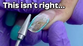 Gel Ruined Her Nails?! The Damage I Found Underneath