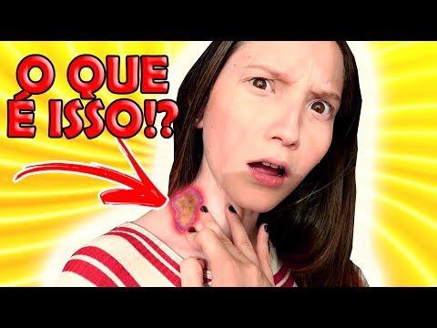 QUE MANCHA É ESSA ???/ ZABETTARESPONDE