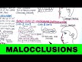 Malocclusion Classification and Definitions