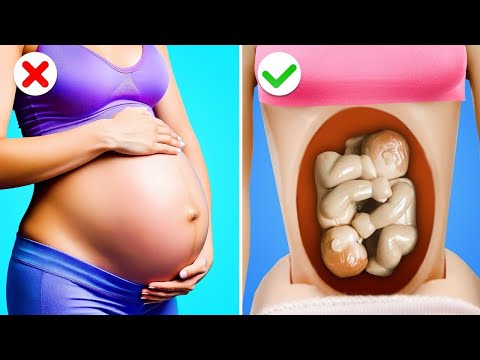 रिच बनाम ब्रोक प्रेग्नेंट - स्क्विड गेम डॉल बनाम बार्बी || स्मार्ट प्रेग्नेंसी गैजेट्स
