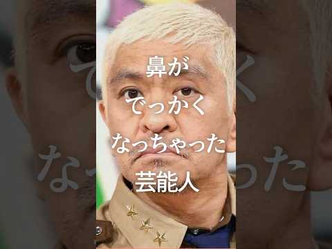 ㊗️100万再生！鼻がでっかくなっちゃった芸能人　#ガルちゃん #芸能人 #鼻