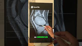 Knee MRI Interpretation Simplified! 🚀🤩 | Easy Guide for Physios