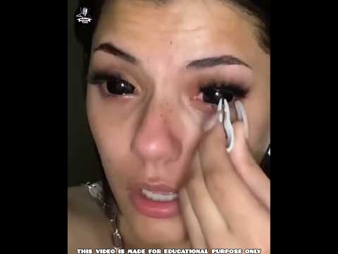 Eye Lens - നെ എങ്ങനെയാണ് നീക്കുന്നത് എന്ന് അറിയാമോ?😱 || #shorts