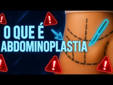 A VERDADE sobre FLACIDEZ ABDOMINAL: Como a Abdominoplastia HD pode MUDAR sua VIDA! DESCUBRA AGORA!
