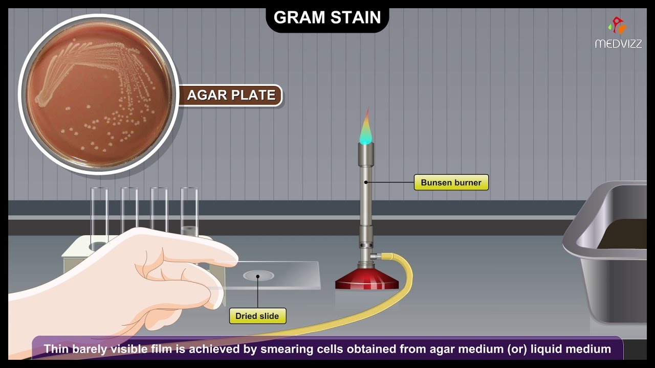 <strong>Gram Staining Virtual Lab Answer Key: A Journey into Microscopic World</strong>