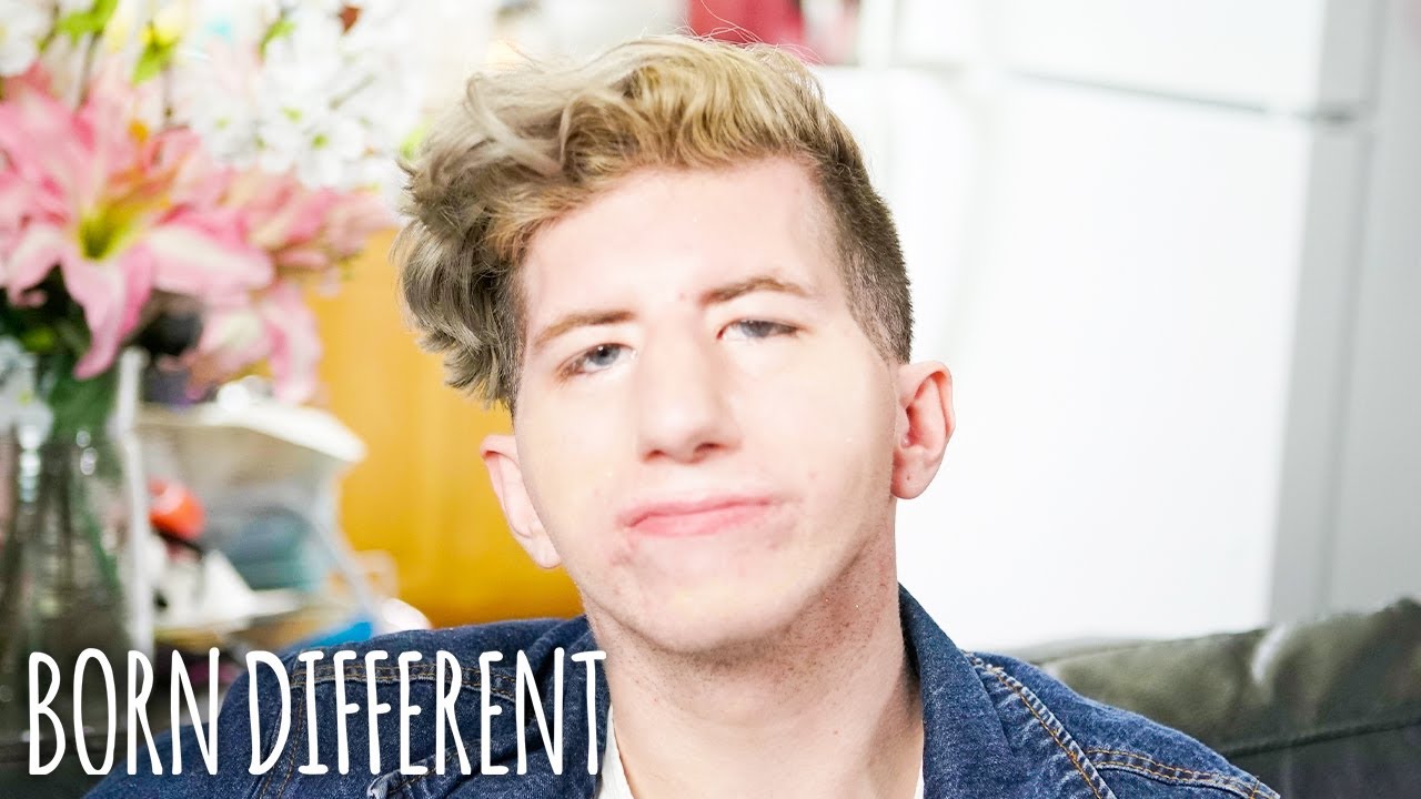 My face is paralysed so i can't smile - born different