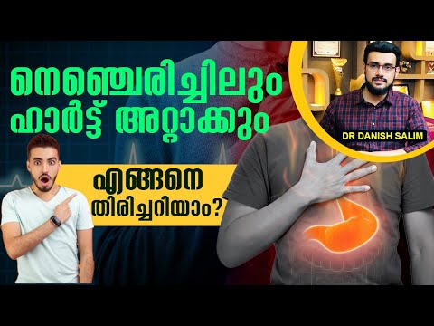 നെഞ്ചെരിച്ചിലിന്റെ കാരണങ്ങൾ | നെഞ്ചെരിച്ചിൽ ഹാർട്ട് അറ്റാക്കിൽ നിന്ന് തിരിച്ചറിയാം? Acidity