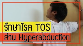 รักษาโรค TOS ส่วน Hyperabduction syndrome กับอาการปวดคอก็ไม่ใช่ ปวดไหล่ก็ไม่เชิง part 2