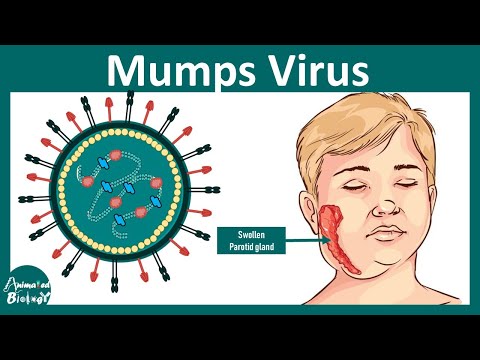 Mumps | Mumps virus | Pathology, diagnosis and treatment