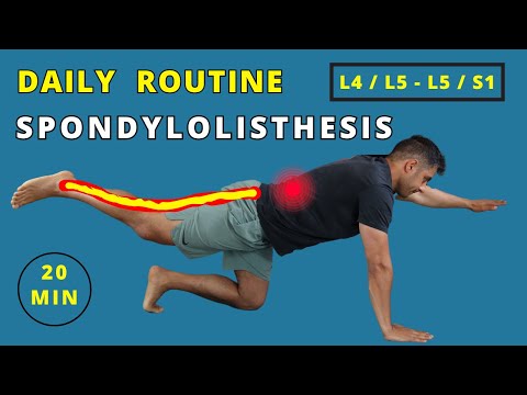 Daily workout Routine for Spondylolisthesis